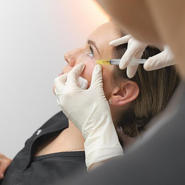 Así se realiza el PRP facial.